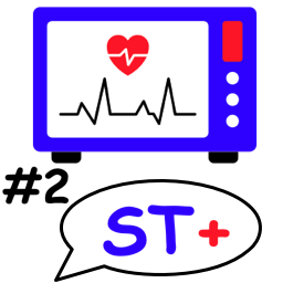 ST+ et infarctus aigu #2